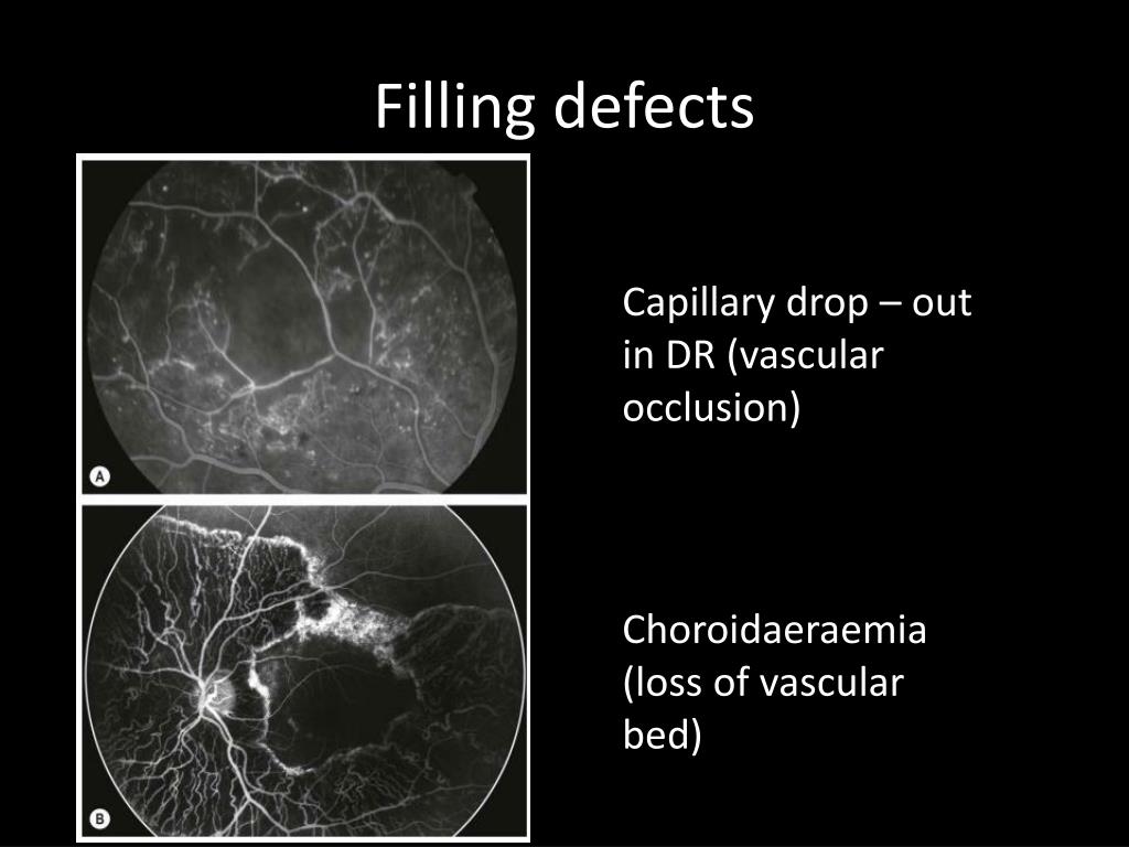 PPT FFA PowerPoint Presentation, free download ID3619279