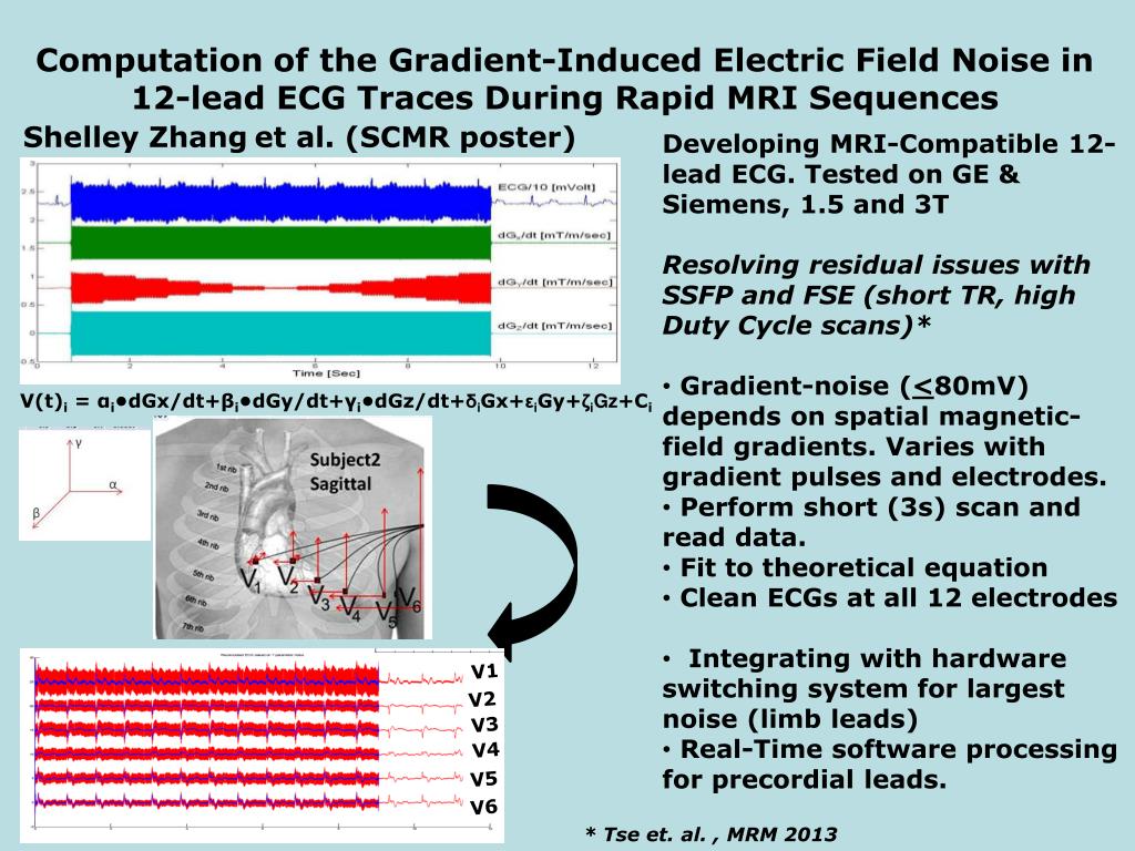 PPT Shelley Zhang et al. (SCMR poster) PowerPoint Presentation, free