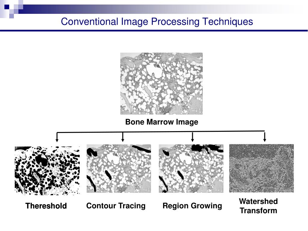 PPT Medical Image Classification by Mathematical Morphology Operators PowerPoint Presentation