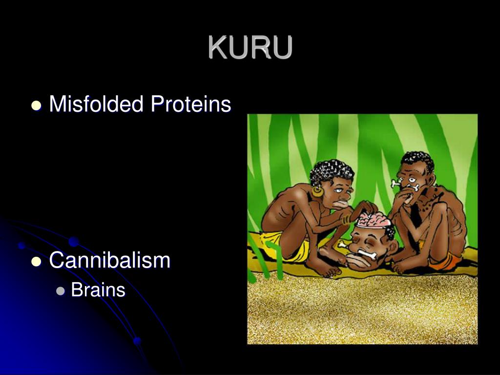 PPT CJD and Kuru Prion Viruses PowerPoint Presentation, free