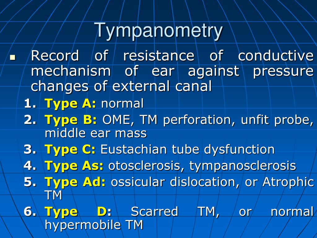 PPT Auditory Assessment PowerPoint Presentation, free download ID