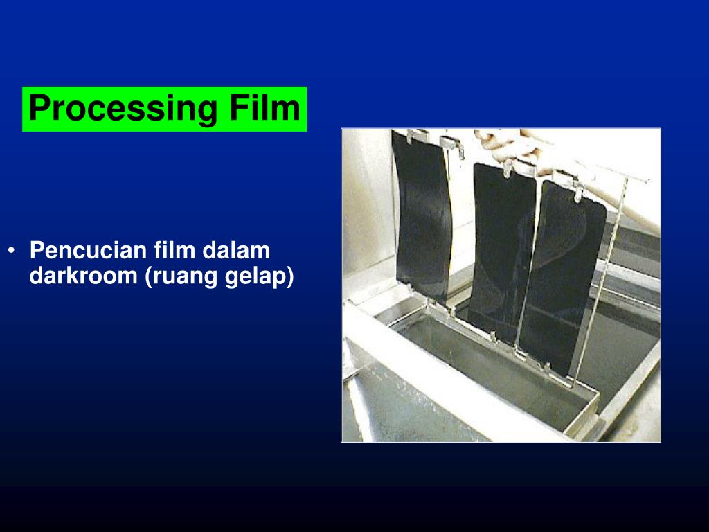 PPT RADIOGRAPHY TEST PowerPoint Presentation, free download ID3624560