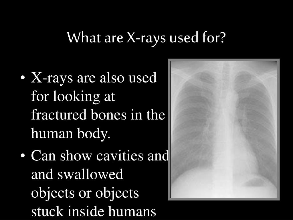 PPT XRays PowerPoint Presentation, free download ID3647257
