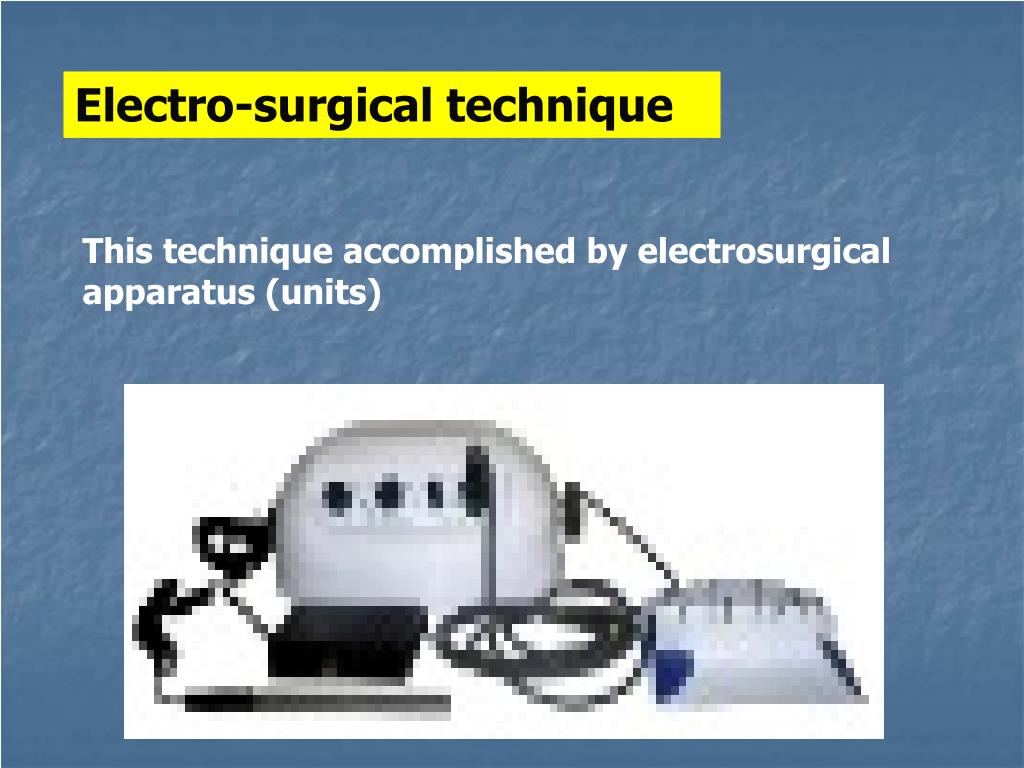 PPT common errors of tooth preparation PowerPoint Presentation, free