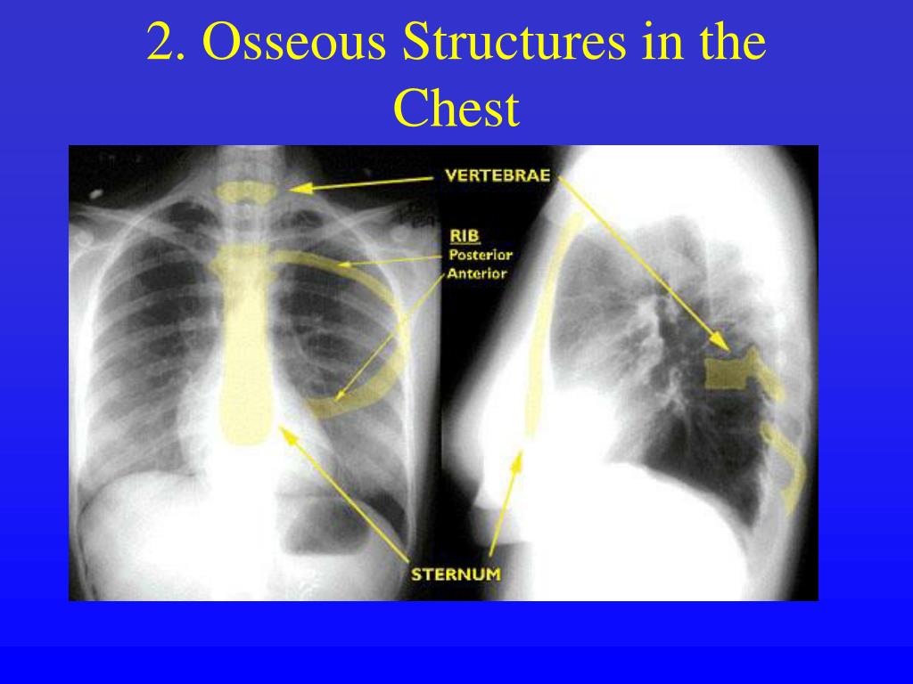 PPT Reading the CXR PowerPoint Presentation, free download ID3651736