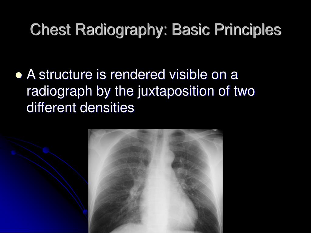 PPT Chest Radiography Interpretation PowerPoint Presentation, free download ID3652162
