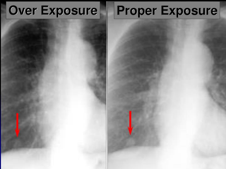 PPT Chest Radiography Interpretation PowerPoint Presentation ID3652162