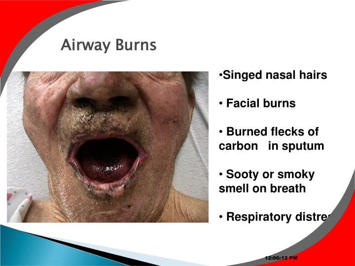 PPT FIRST AID AWARENESS PowerPoint Presentation ID3653481