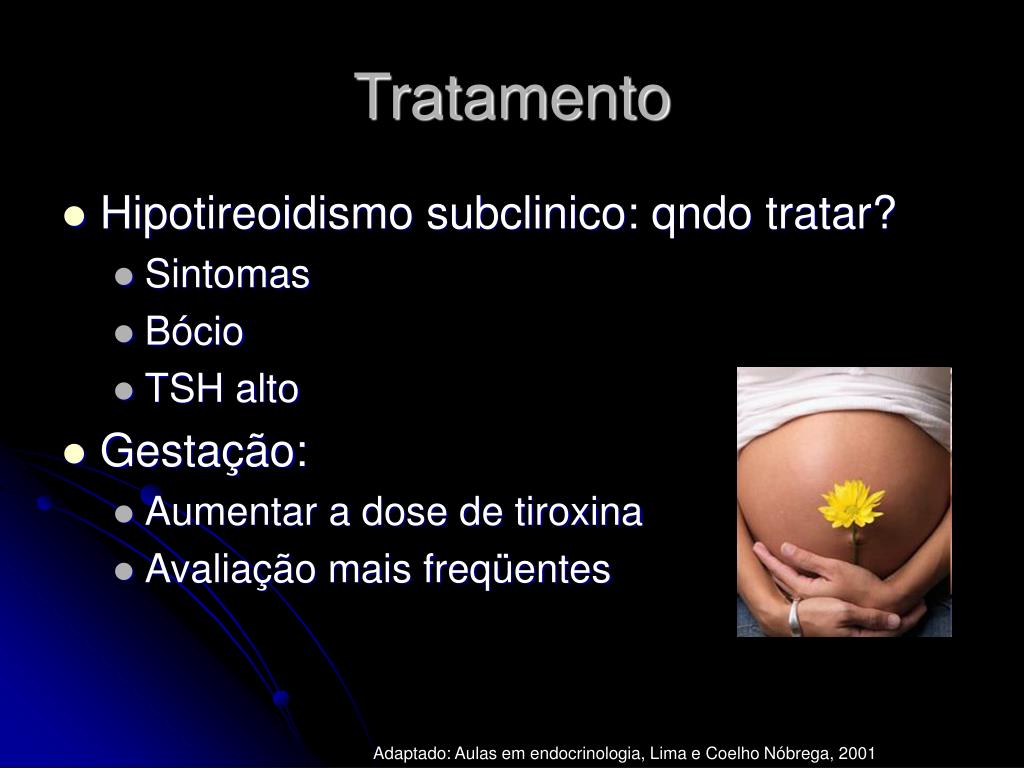 PPT Hipotireoidismo PowerPoint Presentation, free download ID3661605