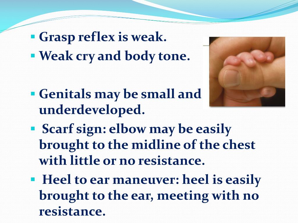 PPT Preterm Infants PowerPoint Presentation, free download ID3670377