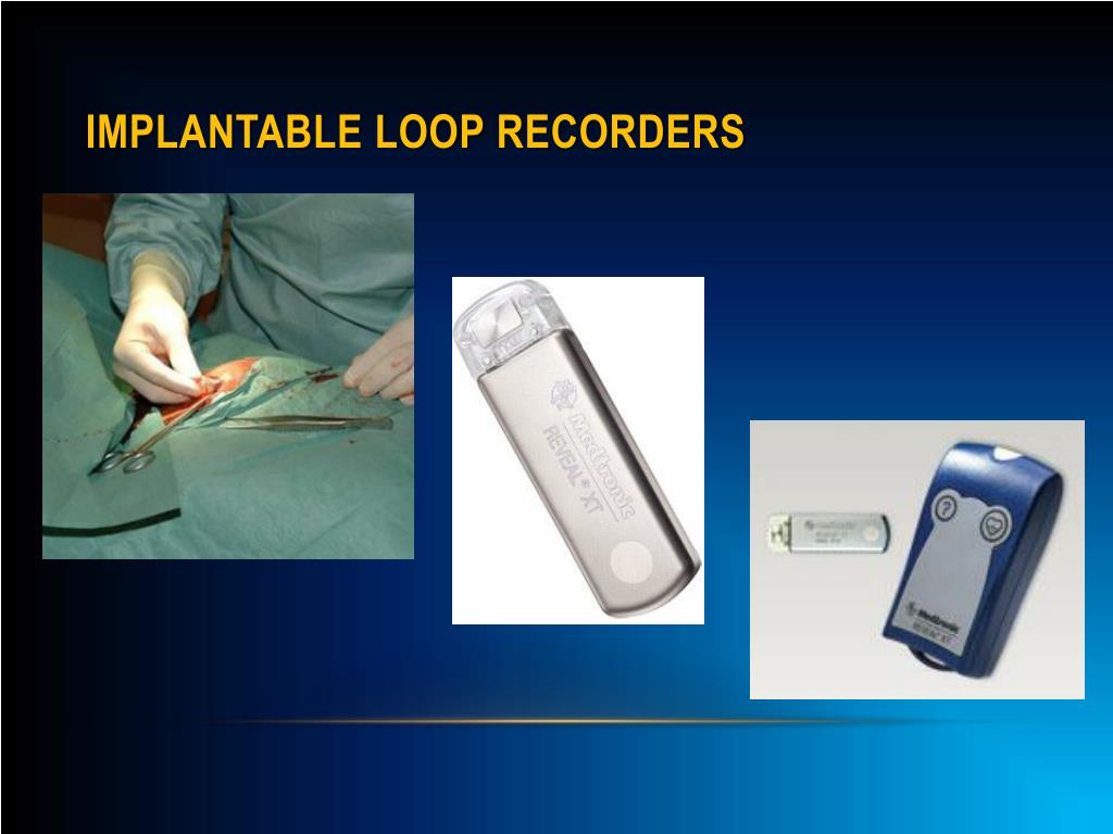 PPT DIAGNOSING & TREATING PALPITATIONS PowerPoint Presentation ID