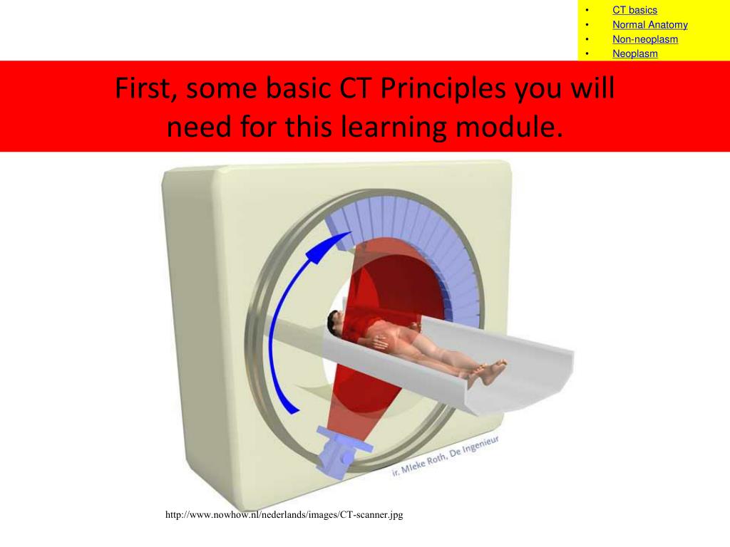 PPT CT Anatomy and Pathology of Uterus and Ovaries PowerPoint