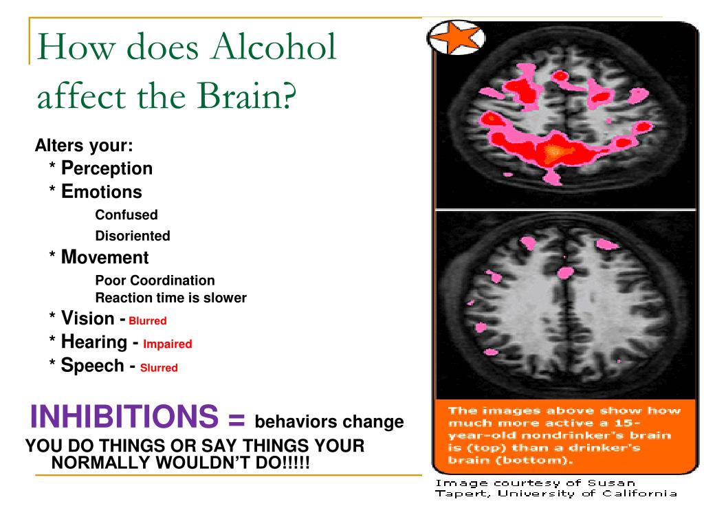 PPT ALCOHOL PowerPoint Presentation, free download ID3699313