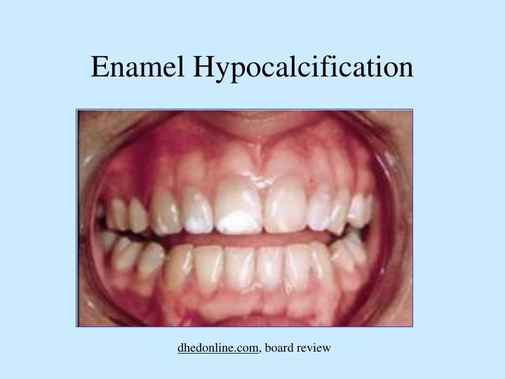 PPT Dental Anomalies PowerPoint Presentation ID3700780