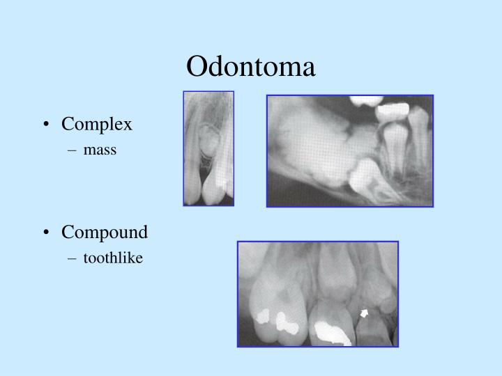 PPT Dental Anomalies PowerPoint Presentation ID3700780