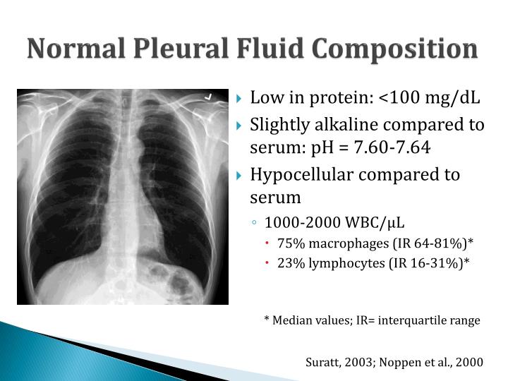 PPT Diagnostic Approach to Pleural Effusion PowerPoint Presentation