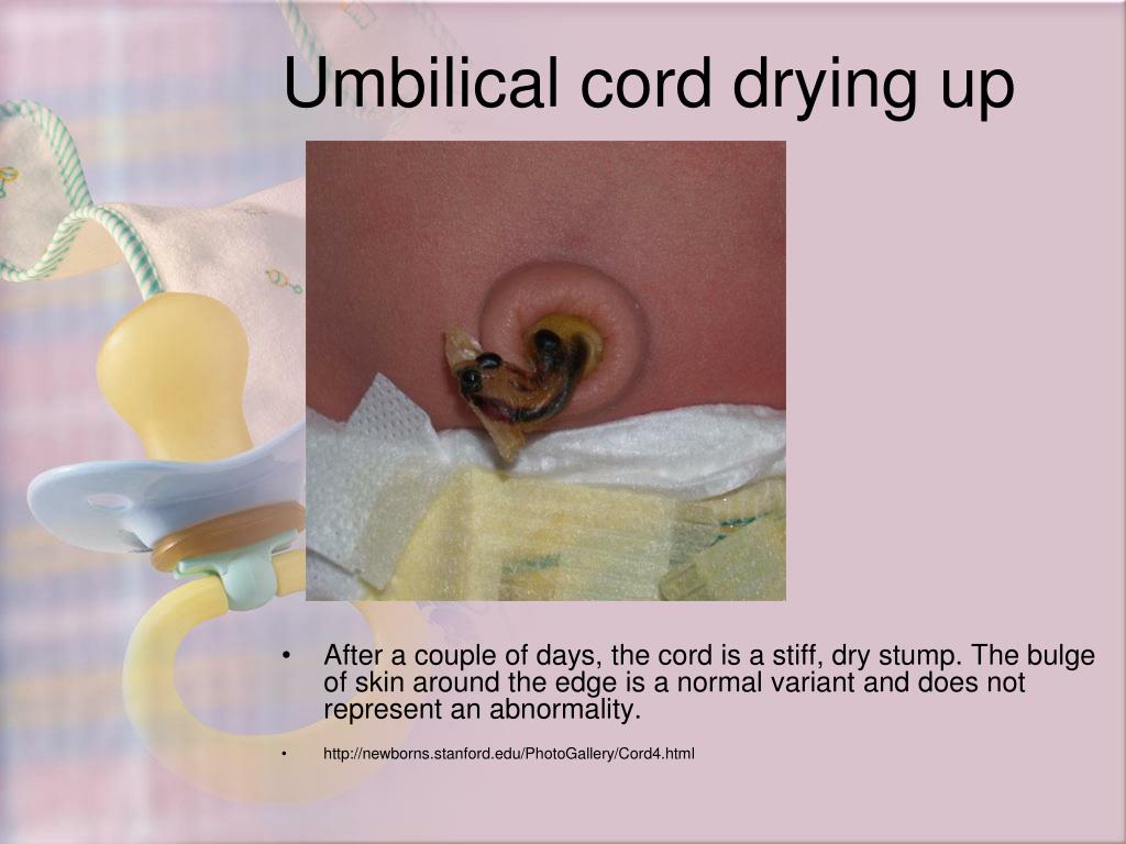 PPT Newborn Appearance PowerPoint Presentation, free download ID