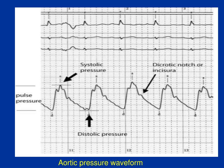 PPT Cathlab hemodynamics 1 pressures, waveforms ,cardiac output and