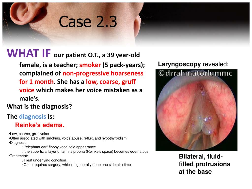 PPT ENT PowerPoint Presentation, free download ID3762654