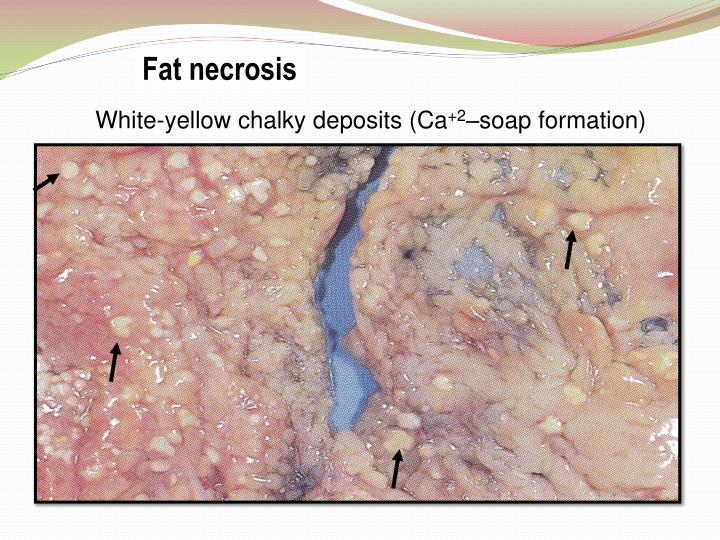 PPT Cell injury PowerPoint Presentation ID3767783
