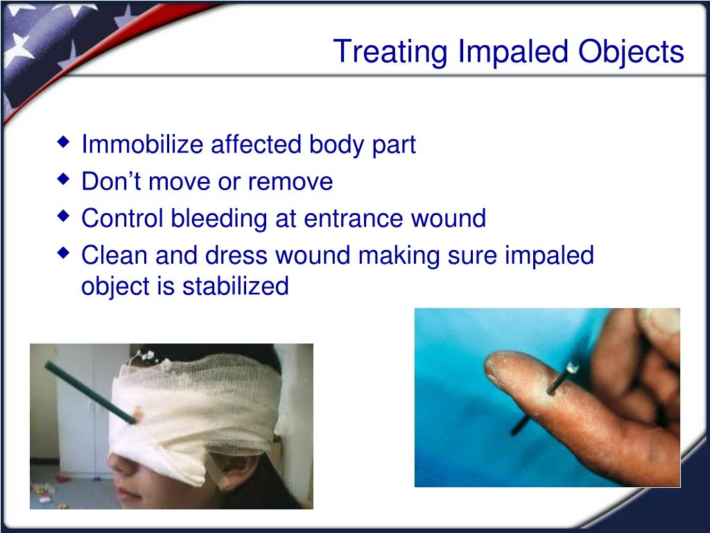 PPT Disaster Medical Operations Part 1 PowerPoint Presentation, free