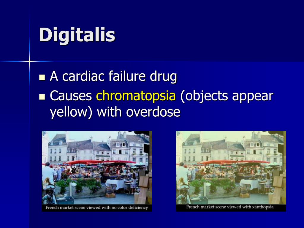 PPT Ocular pharmacology and toxicology PowerPoint Presentation, free download ID3777543