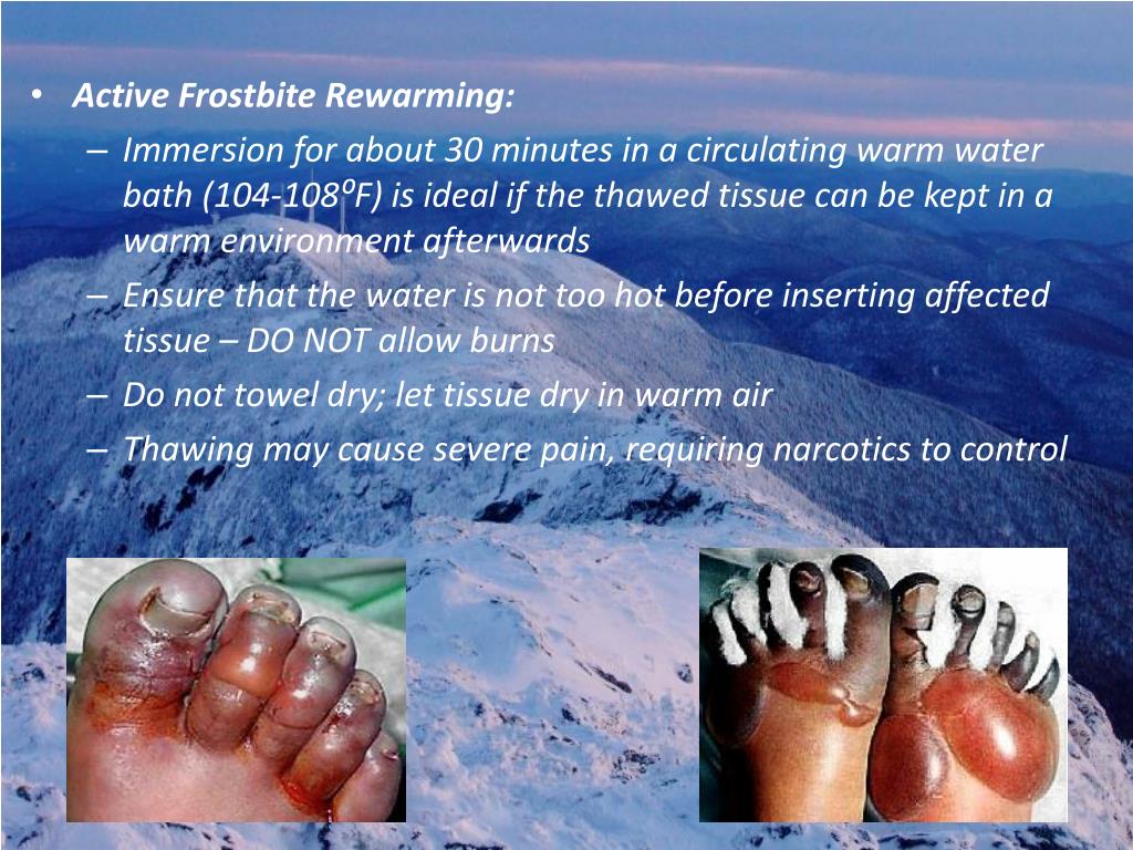 PPT COLD INJURY PowerPoint Presentation, free download ID3799409