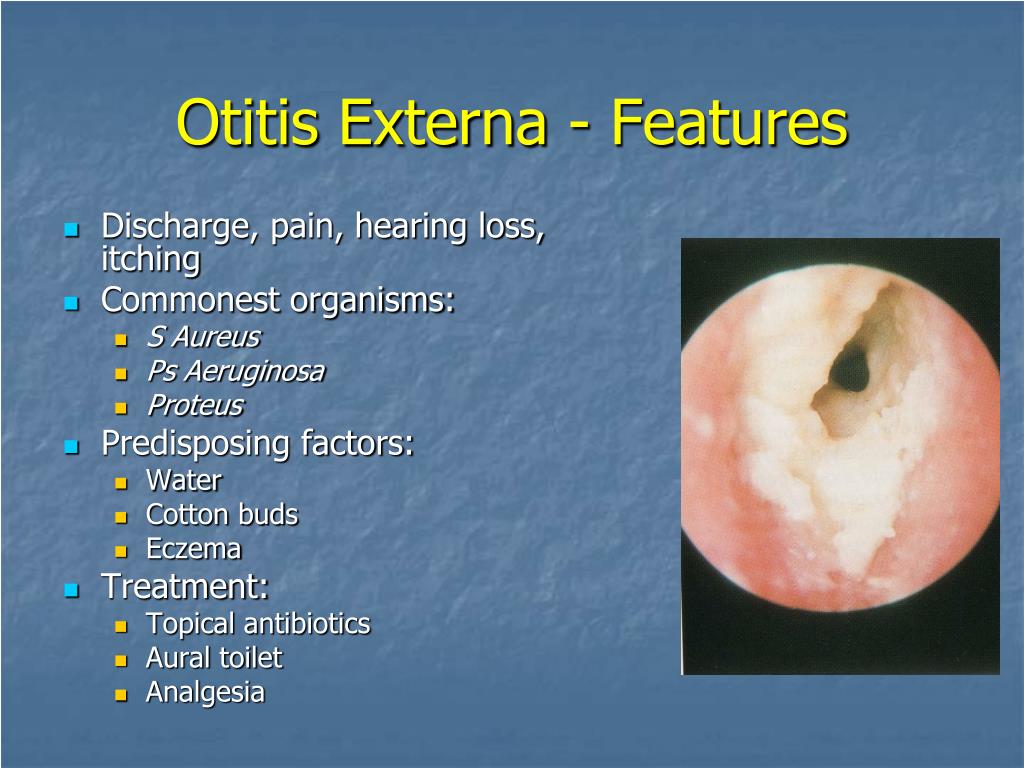 Otitis Externa Causes