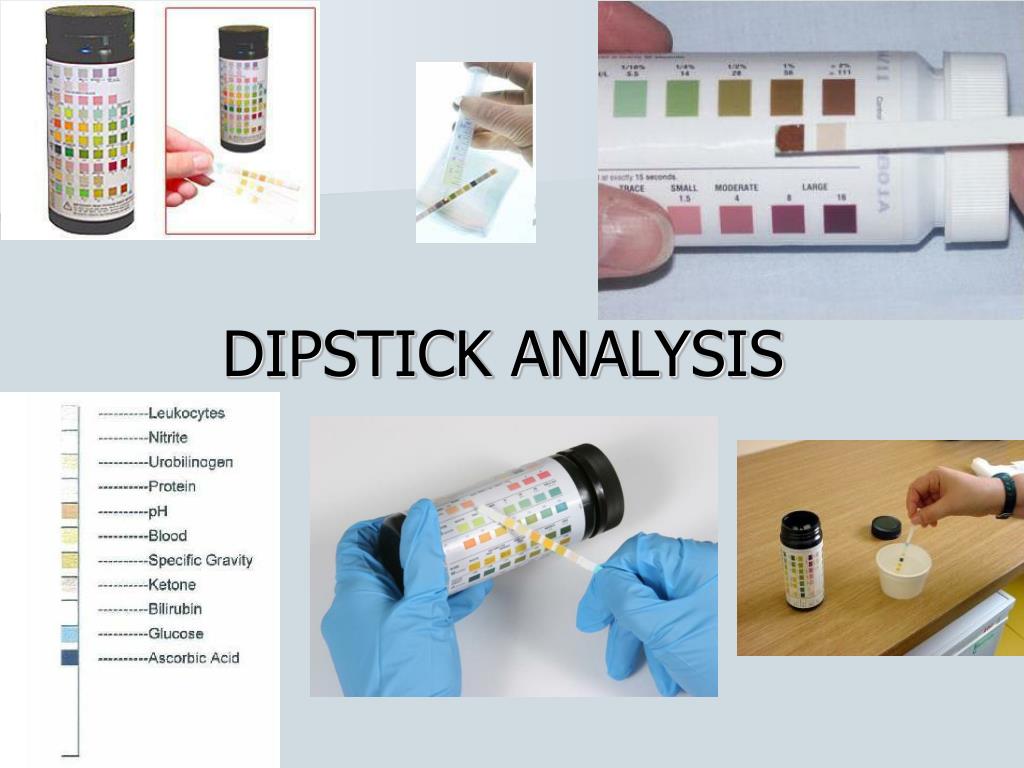 PPT URINALYSIS (UA) PowerPoint Presentation, free download ID3829178
