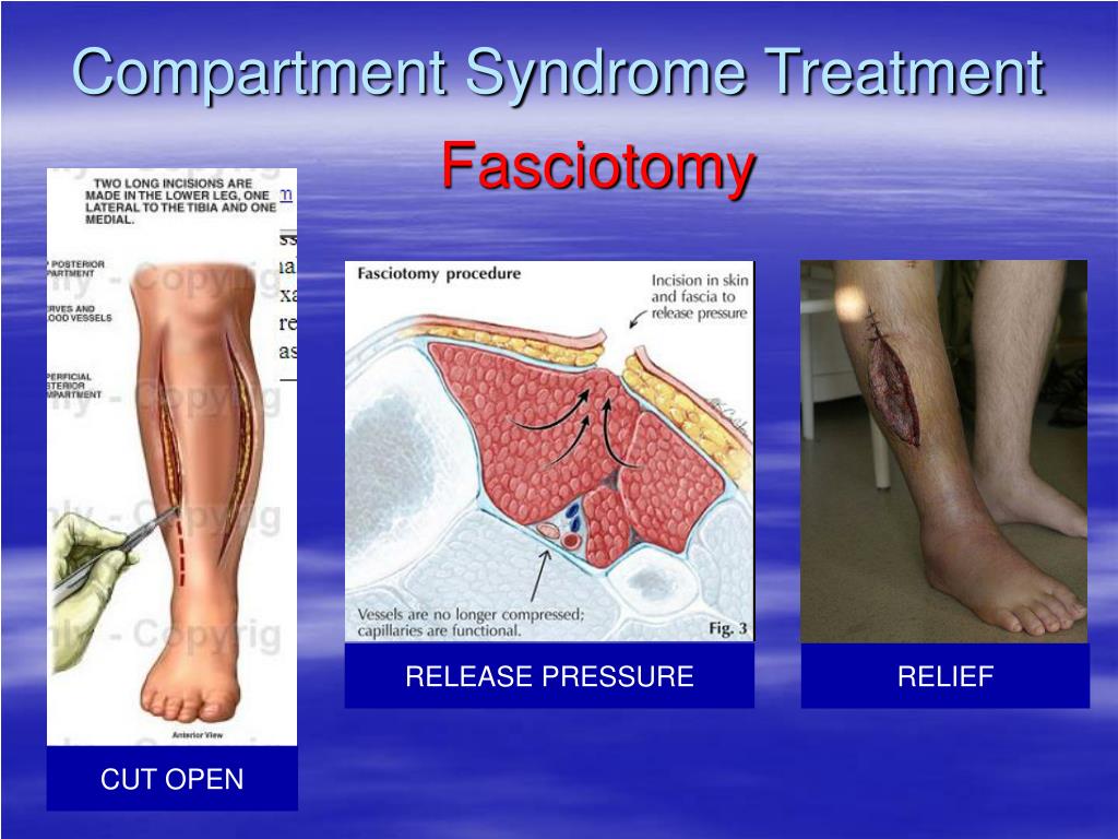 PPT Nursing Care of Clients With Musculoskeletal Disorders PowerPoint