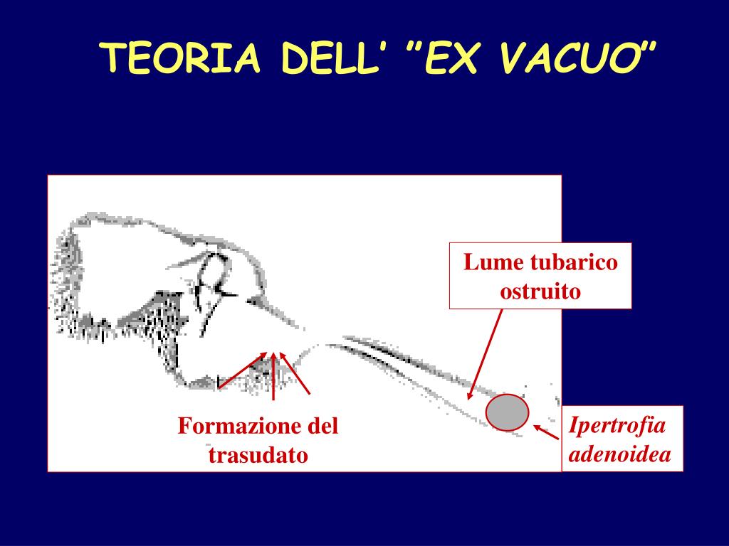 PPT TUBA DI EUSTACHIO PowerPoint Presentation, free download ID3836178