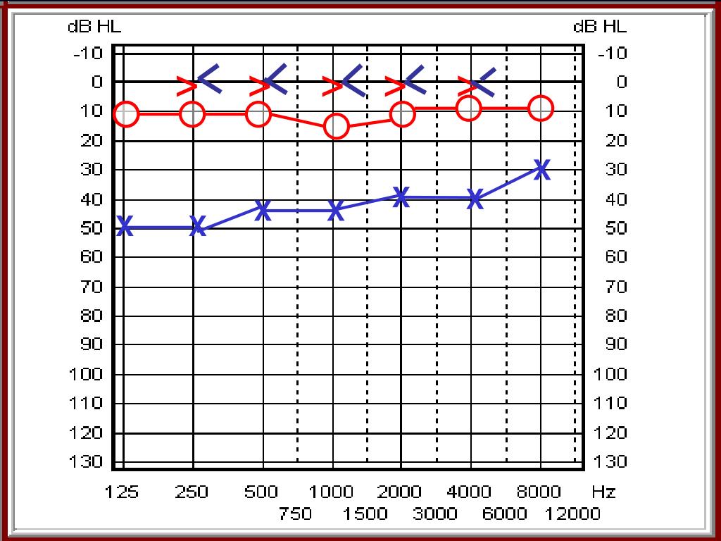 PPT TUBA DI EUSTACHIO PowerPoint Presentation, free download ID3836178