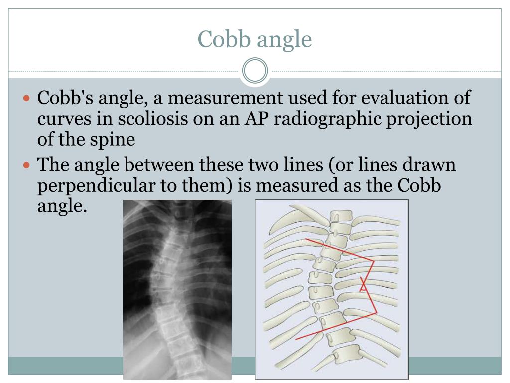 PPT Spinal Posture Analysis technique using Diagnostic Imaging