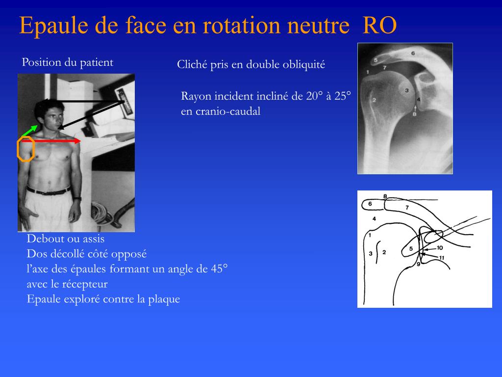 Cheville : anatomie info-radiologie