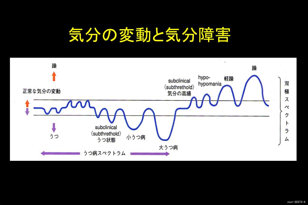 PPT 双極性（感情）障害の薬物療法 PowerPoint Presentation ID3905410