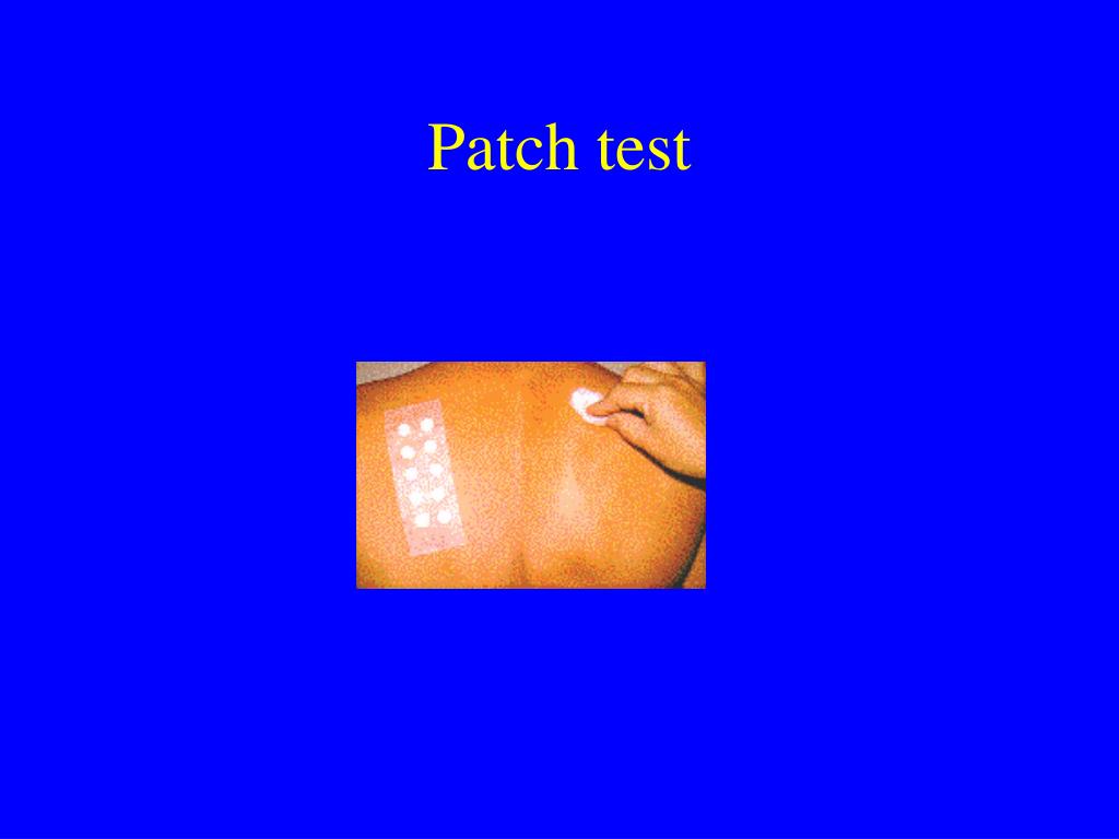 PPT Immunology Chapter 17 PowerPoint Presentation, free download ID