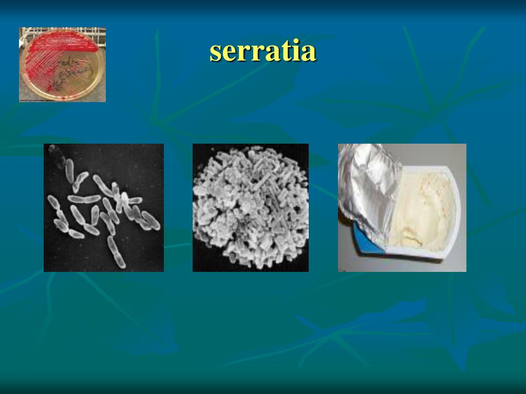 PPT GELATIN LIQUEFACTION TEST PowerPoint Presentation, free download