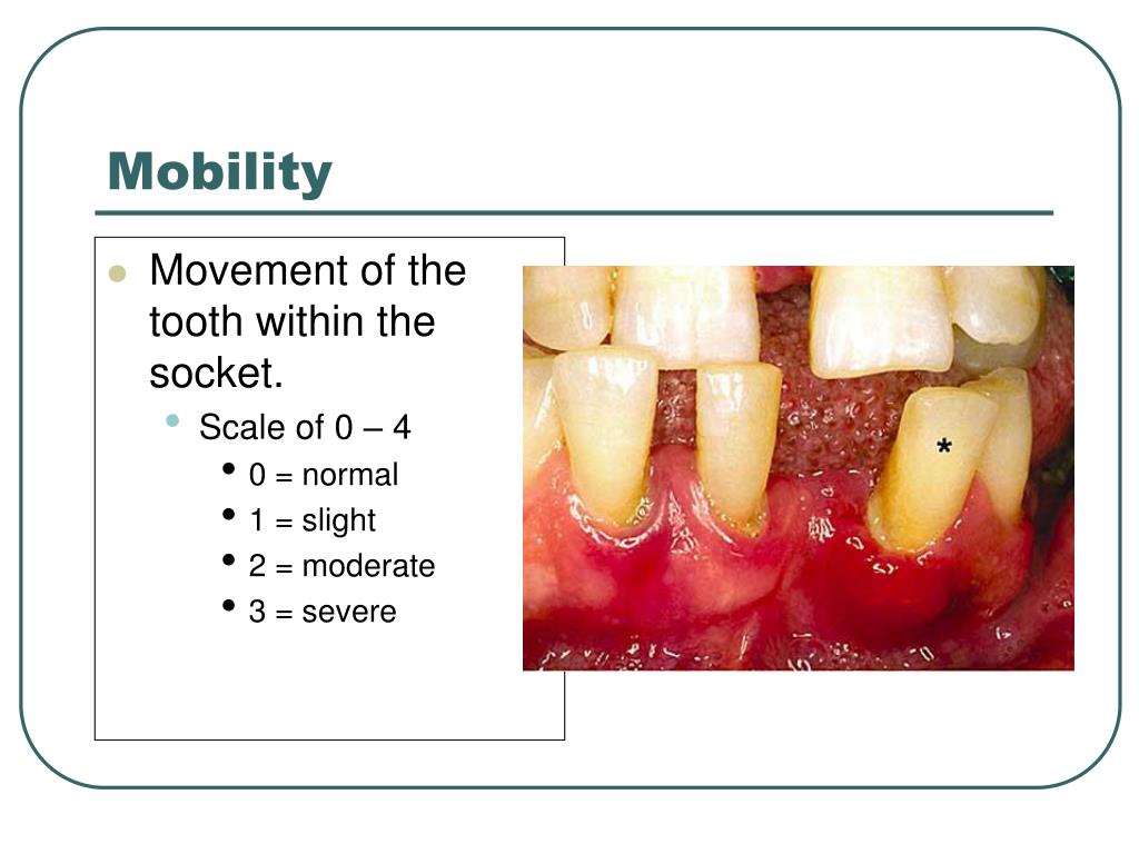 PPT Periodontics PowerPoint Presentation, free download ID3945306