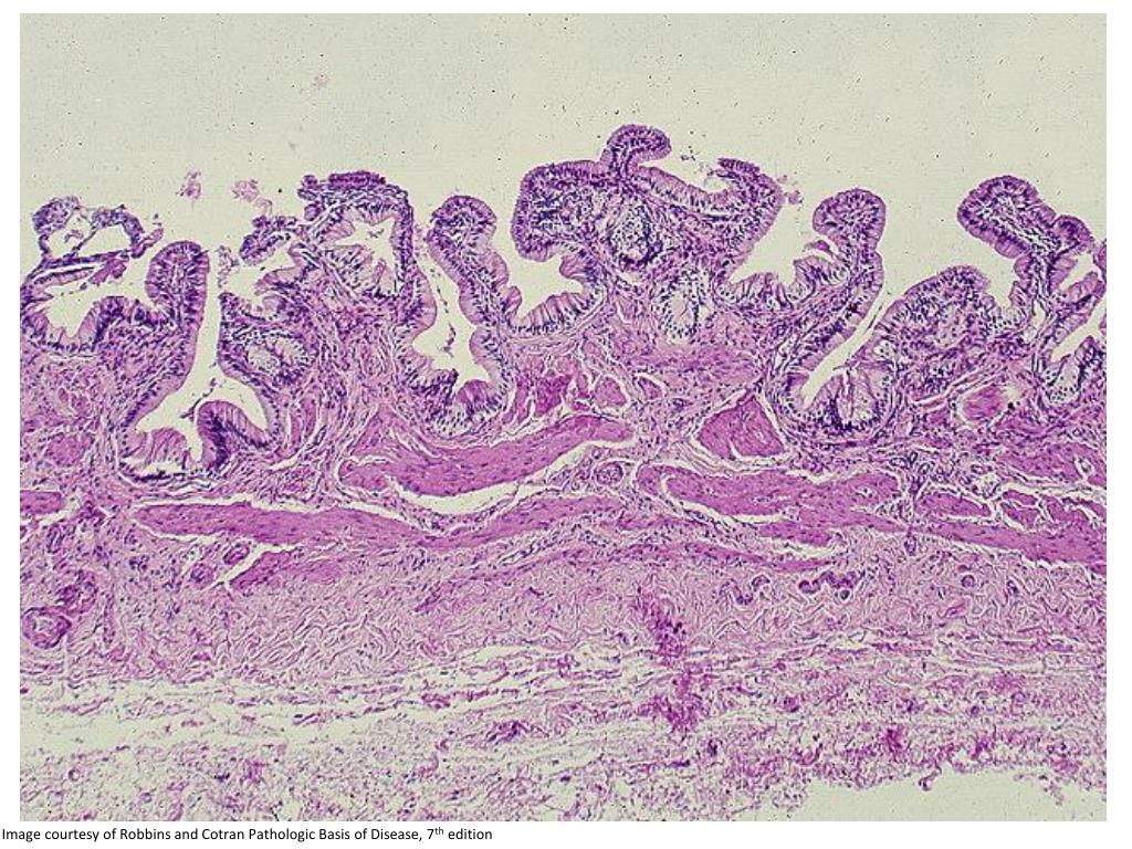 PPT Histology for Pathology Hepatobiliary System (Accessory Digestive