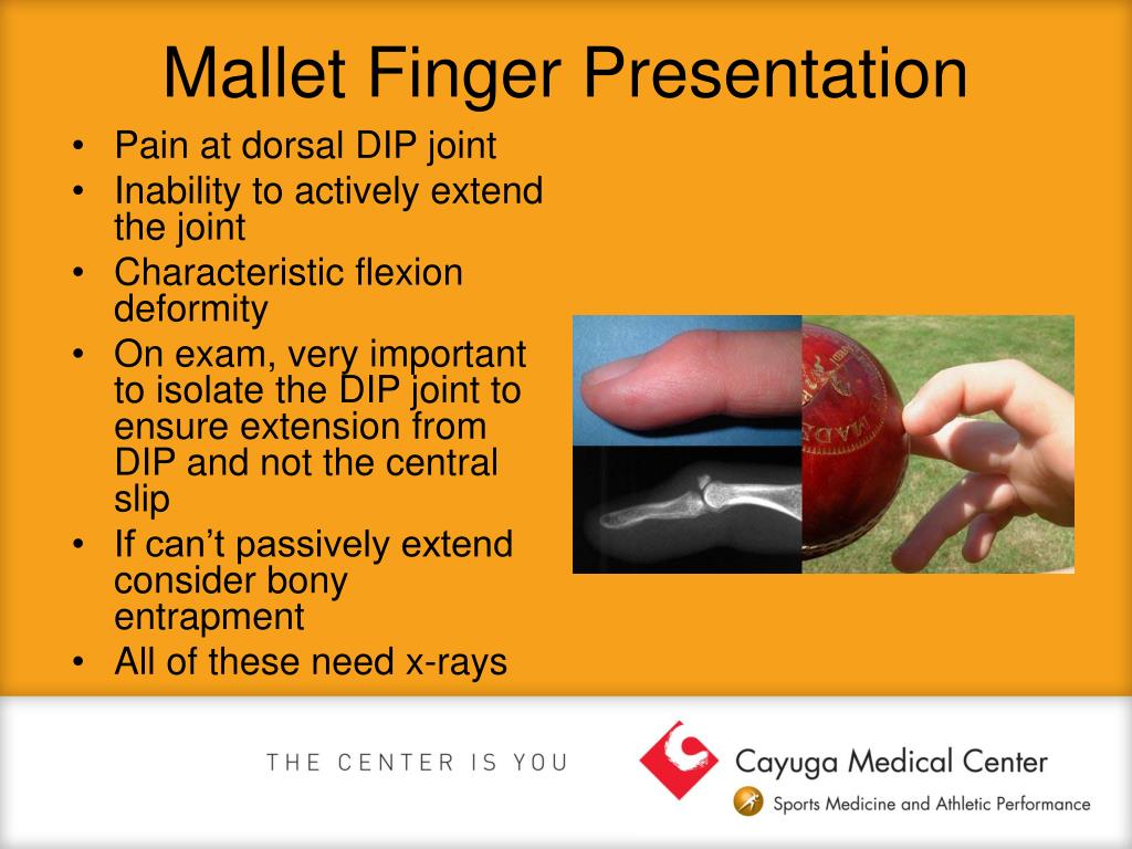 PPT Common Hand and Wrist Injuries PowerPoint Presentation, free