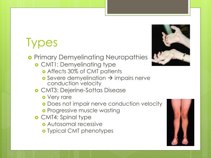 PPT CharcotMarieTooth Disease PowerPoint Presentation
