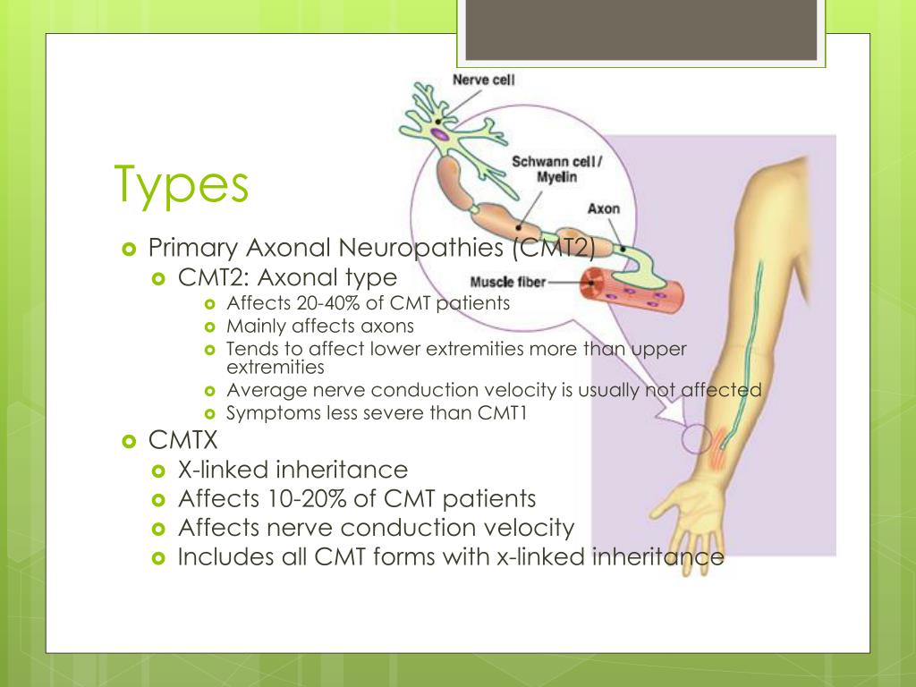 PPT CharcotMarieTooth Disease PowerPoint Presentation