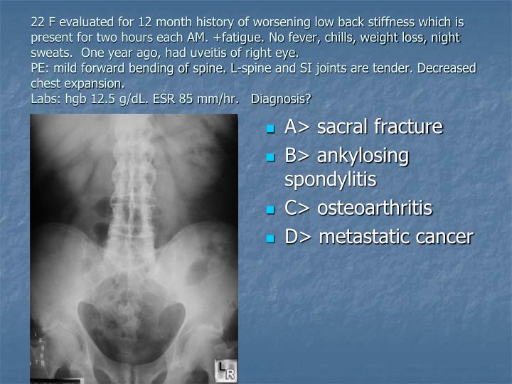 PPT Rheumatology Board Review PowerPoint Presentation ID4000053