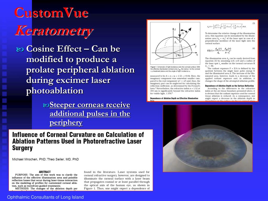 PPT Multifocal LASIK for Correction of Presbyopia with a Variable