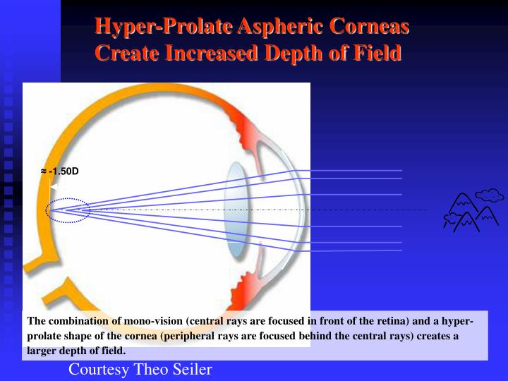 PPT Multifocal LASIK for Correction of Presbyopia with a Variable