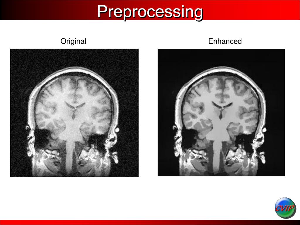 PPT Medical Image Processing PowerPoint Presentation, free download