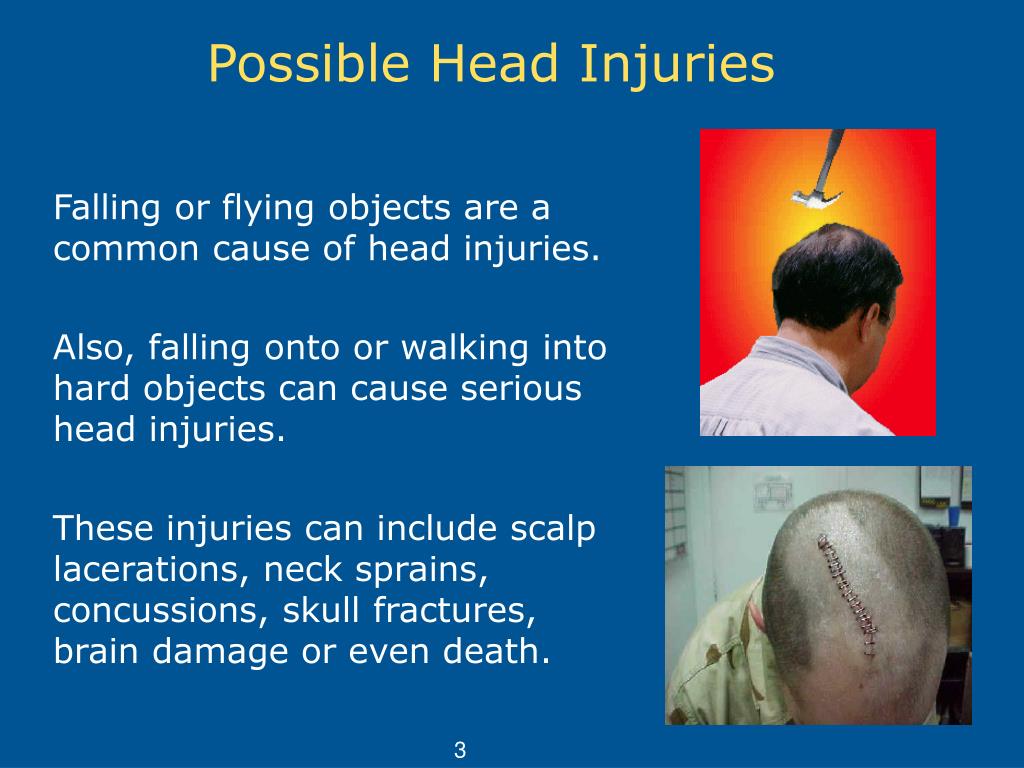 PPT Head Protection (Hard Hats) PowerPoint Presentation, free