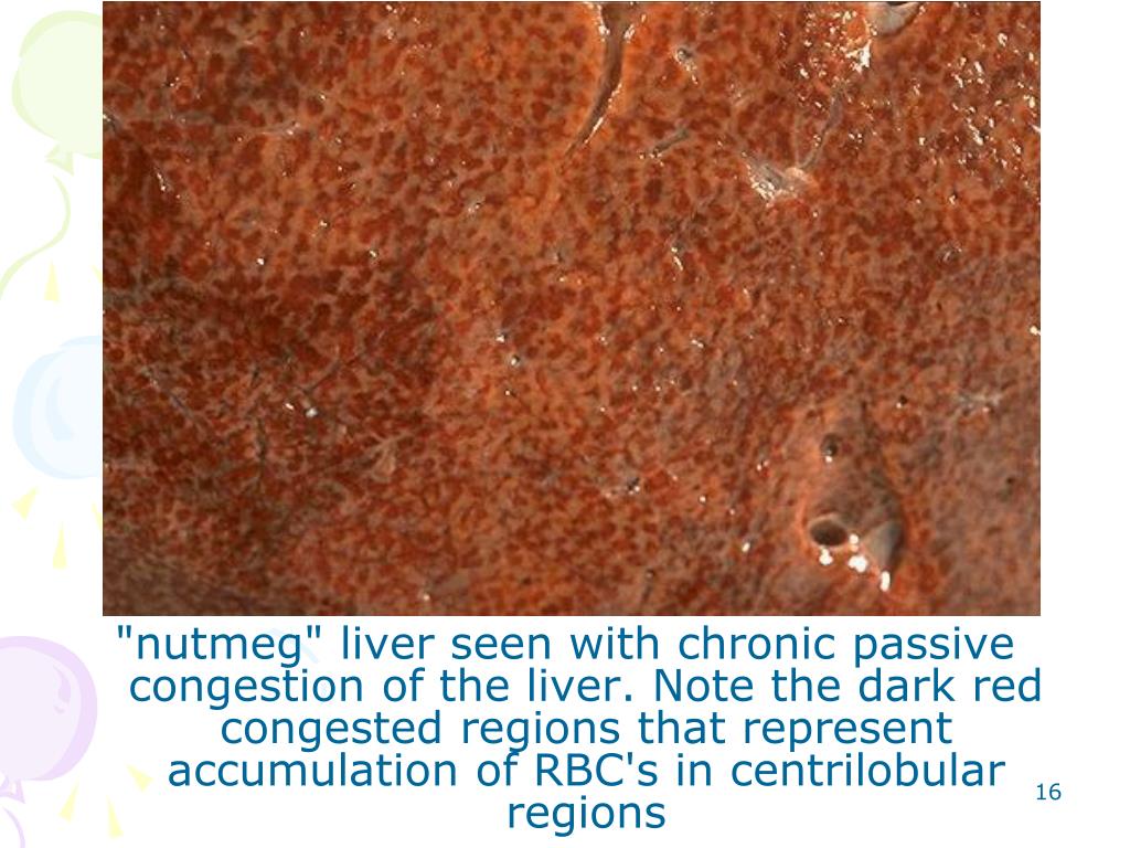 PPT The Pathology of Liver & Biliary System Part1 PowerPoint