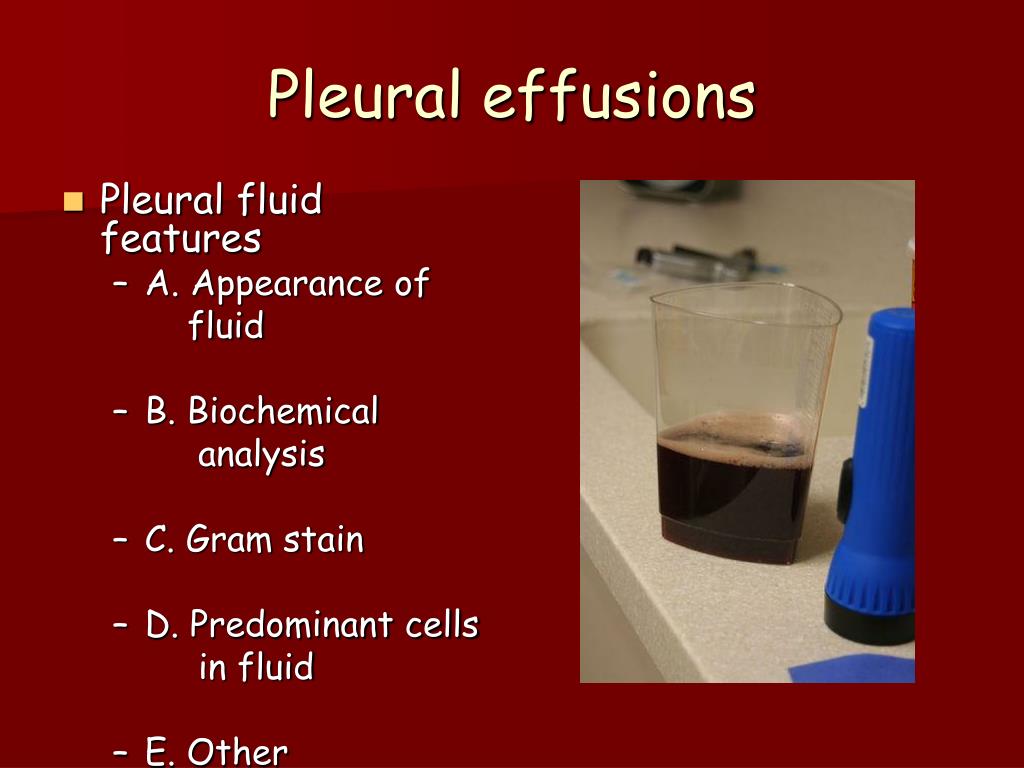 PPT Pleural diseases Case Studies PowerPoint Presentation, free download ID4046038