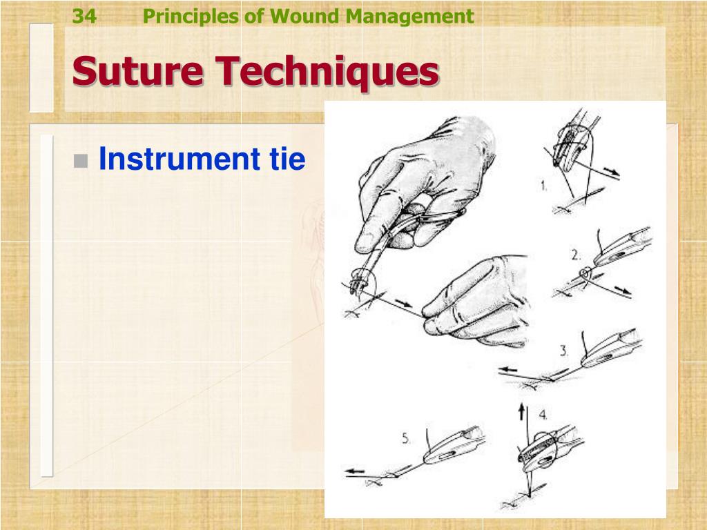 PPT Wound Management PowerPoint Presentation, free download ID4063474